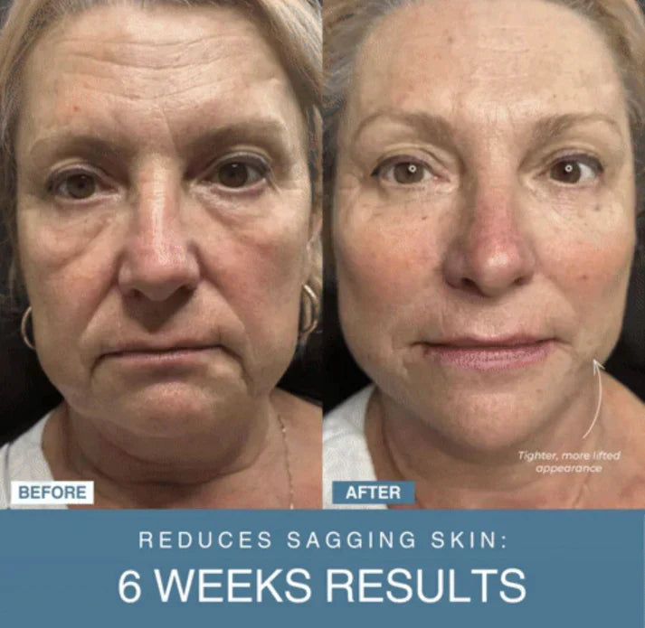 𝙏𝙧𝙪𝙢𝙯𝙮™  7-in-1 LED Anti-Aging/Wrinkle Apparatus