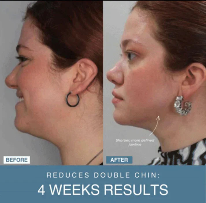 𝙏𝙧𝙪𝙢𝙯𝙮™  7-in-1 LED Anti-Aging/Wrinkle Apparatus