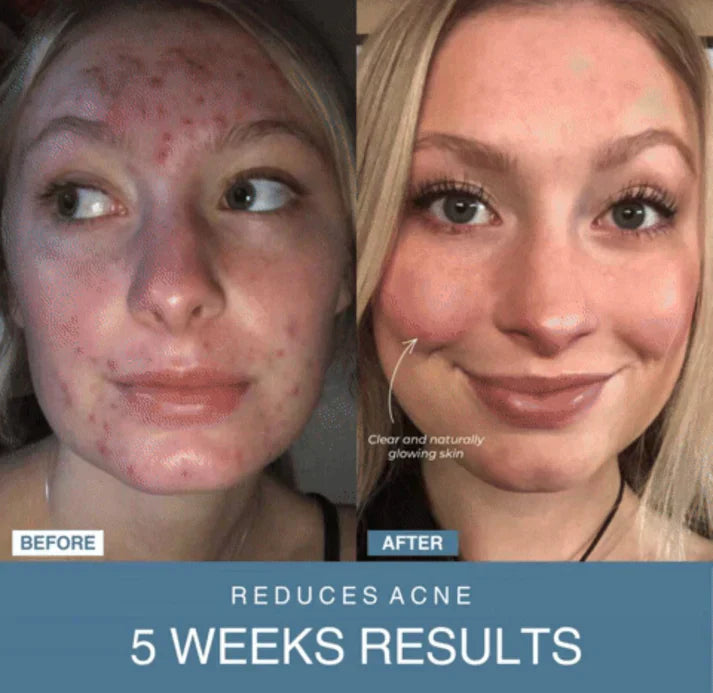 𝙏𝙧𝙪𝙢𝙯𝙮™  7-in-1 LED Anti-Aging/Wrinkle Apparatus